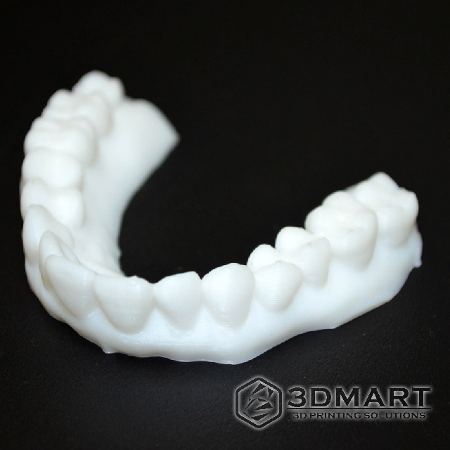 3D列印，牙齒，齒模，HIPS, ULTIMAKER2