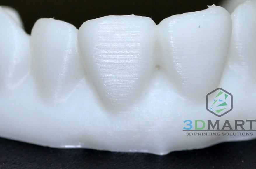 3D列印，牙齒，齒模，HIPS, ULTIMAKER2