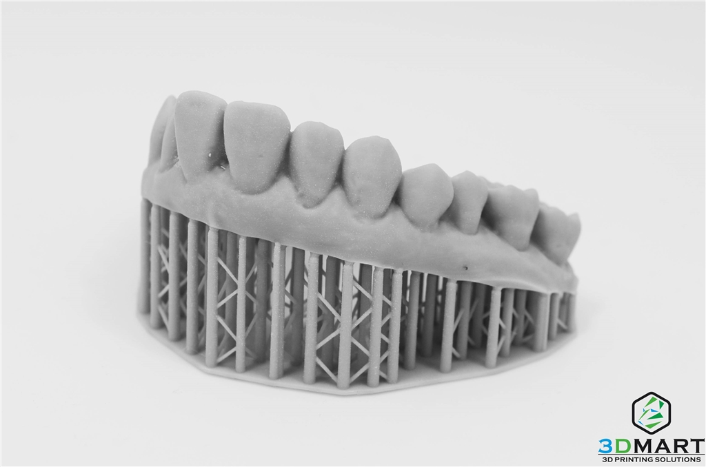 牙齒模型側面