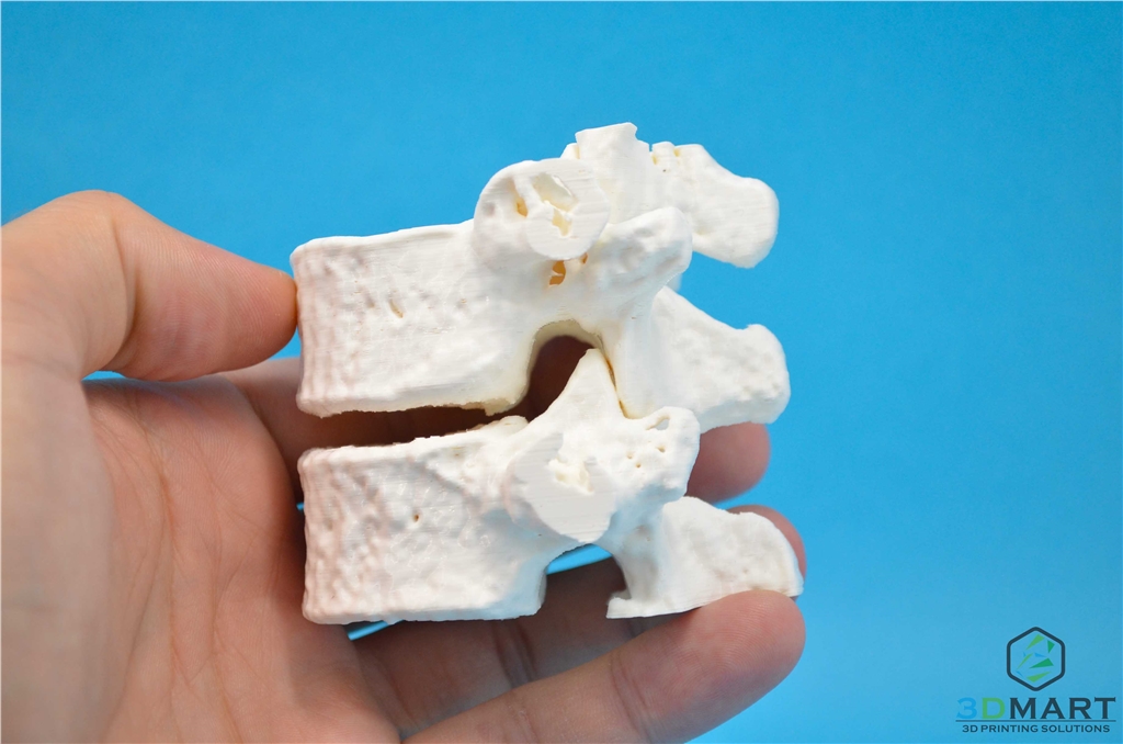 3DMART Ultimaker3 雙噴頭 3D列印機 水溶性支撐  骨頭模型成品